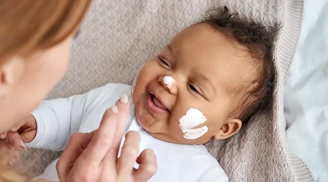 Natural Ways to Protect Baby Skin